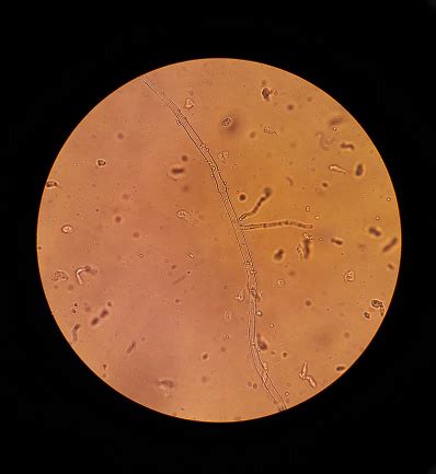 Microscope View Of Fungi Mycelium Filaments 40x Increase Stock Photo ...