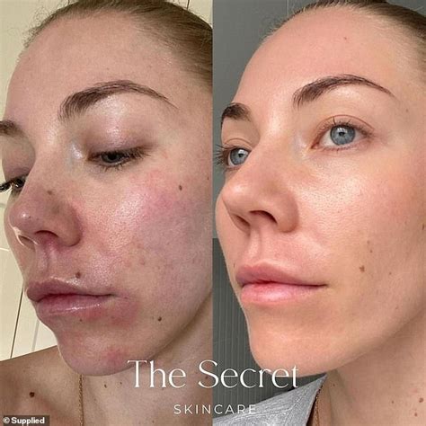 Doctors behind best-selling beauty range list the FIVE top skincare ...