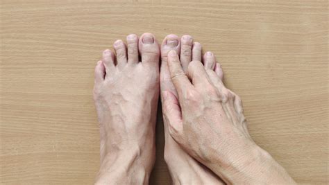 Arthritis: Types, Symptoms, and Treatment - Mountain Spring Podiatry