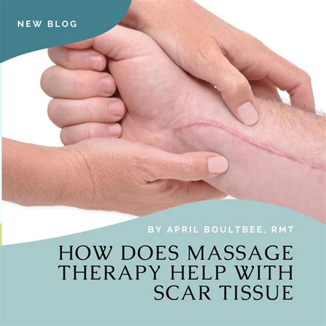 How Does Massage Therapy Help with Scar Tissue