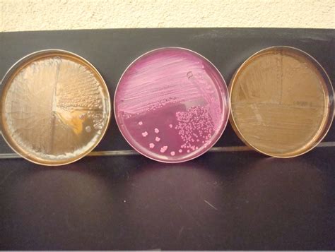 DIFFERENTIATION OF GRAM NEGATIVE BACILLI – Red Mountain Microbiology