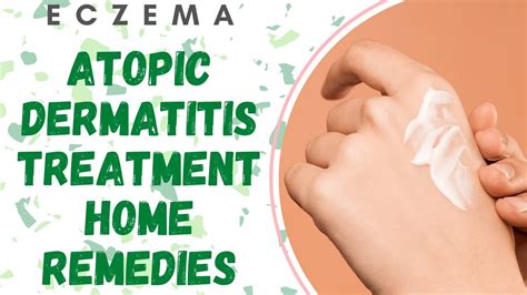 Atopic Dermatitis Treatment Home Remedies - YouTube