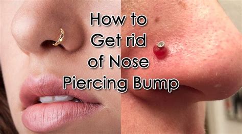 How to Get Rid of Nose Piercing Bump | Nose Piercing | Nose piercing bump, Piercing bump, Nose ...