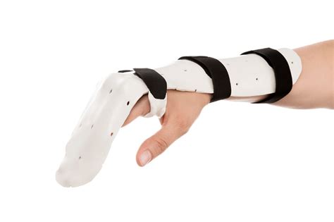 Dorsal Blocking Orthosis for Flexor Tendon Rehabilitation Hand Anatomy, Plastic And ...