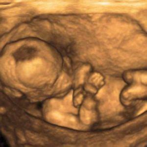 14 to 19 Weeks 3D/4D Pregnant Ultrasound | Tummy Vision