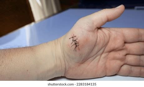 Hand Cut Stitches