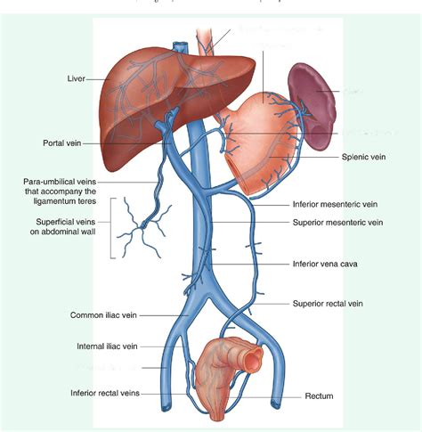 Figure 1 from Clinical manifestations and imaging tools in the diagnosis of splanchnic and ...