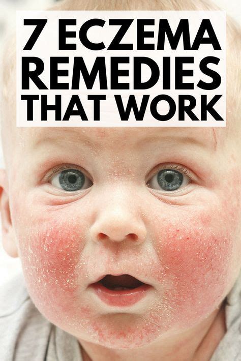 If you're on the hunt for eczema remedies that work quickly and effectively in treating dry ...