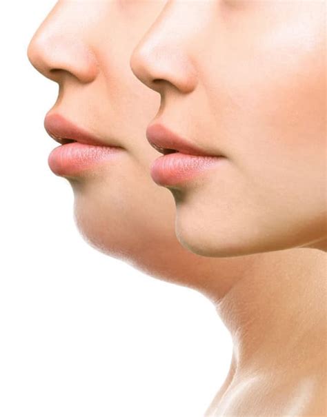 To Face Exercise Or Not? Read To Learn Some Facial Workouts!