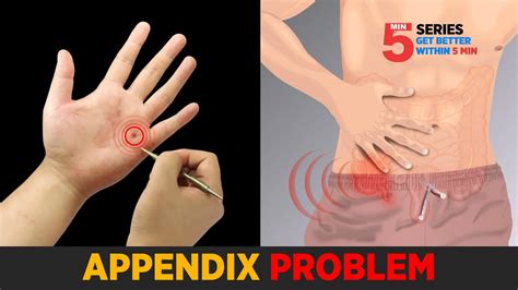 SUJOK TREATMENT FOR APPENDICITIS, APPENDIX PAIN (TREATMENT IN LEFT HAND ...