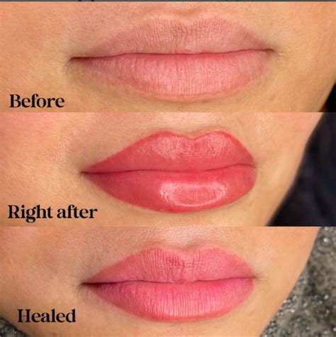 Aggregate more than 72 lip blush tattoo before and after latest - in.eteachers