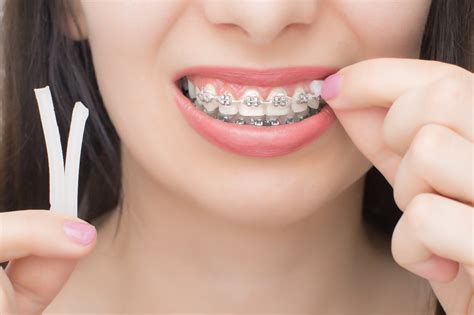 What Is Braces Wax For and How to Use It - Complete Guides