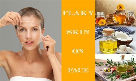 18 Home Remedies How To Treat Flaky Skin On Face Treatment