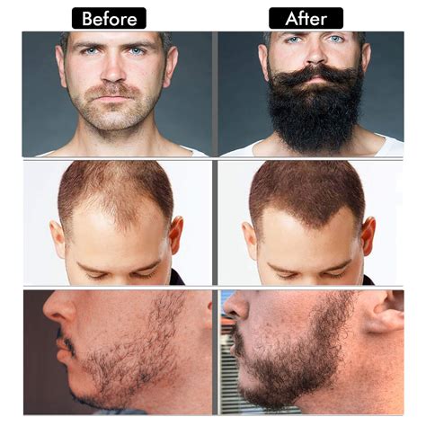 Beard Balm Before And After | ubicaciondepersonas.cdmx.gob.mx