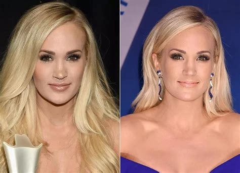 Carrie Underwood Plastic Surgery: Did She Get Lip Surgery? - Luv68