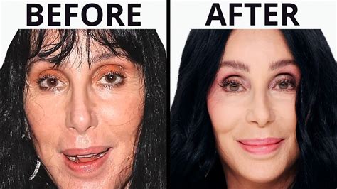 Cher's NEW FACE | Plastic Surgery Analysis - YouTube