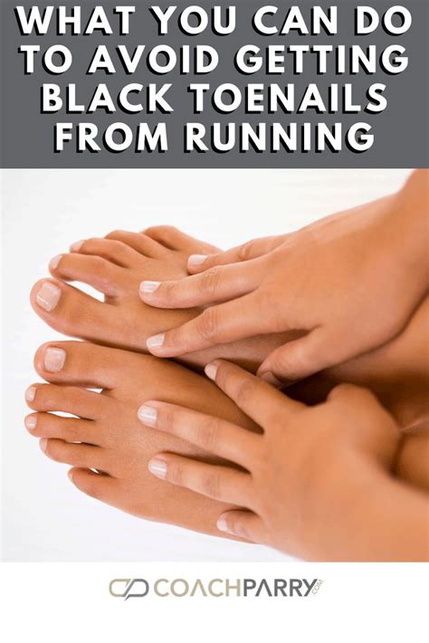 Runners Toe: What causes black toenails in runners in 2020 (With images ...