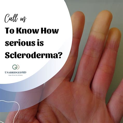 Discover The Future of Scleroderma Treatment - UnabridgedMD