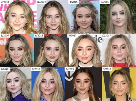 Sabrina Carpenter Plastic Surgery: Botox And Lip Filler