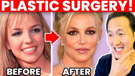 BRITNEY SPEARS Plastic Surgery Transformation- Cosmetic Surgeon Reacts! - Cyber Clinic