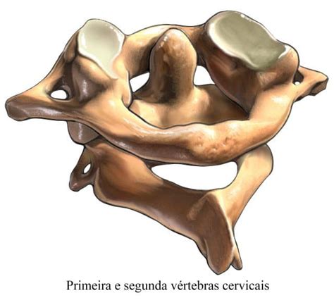 Tontura de origem cervical, sintomas, causas e remédios naturais