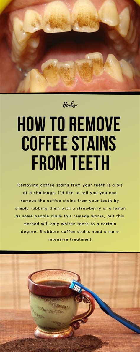 How To Remove Coffee Stains From Dentures - Apartments and Houses for Rent