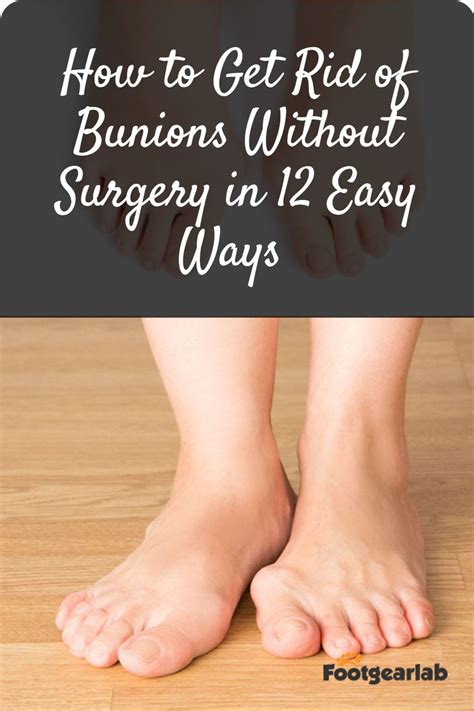 How To Get Rid Of Bunions Without Surgery In 12 Easy Ways in 2021 | Get ...