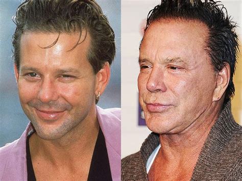 Mickey Rourke Plastic Surgery Before And After Photos - CelebLens.Com