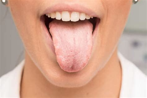 What Causes Dry Mouth & How To Relieve It | SmartMouth