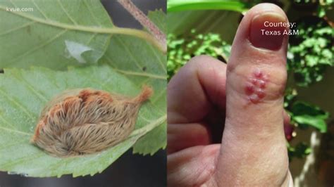 Cute and fluffy asp caterpillars pack painful sting | khou.com