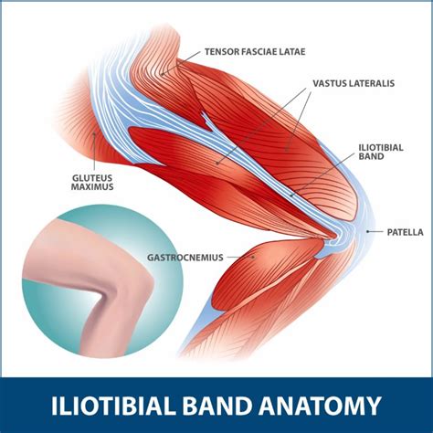 Iliotibial Band Syndrome | Florida Orthopaedic Institute