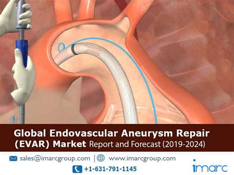 Global Endovascular Aneurysm Repair Market | Marketing, Repair, Aneurysm