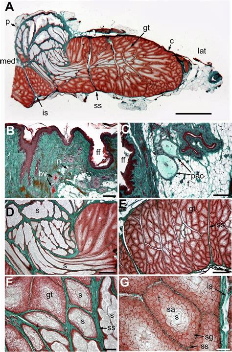 Microphotographs of coronal sections through the left lobe of the... | Download Scientific Diagram