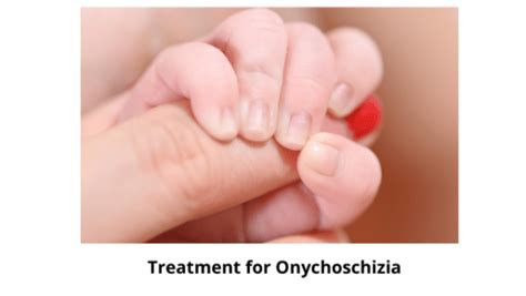 Onychoschizia: Causes, Symptoms, and Treatment