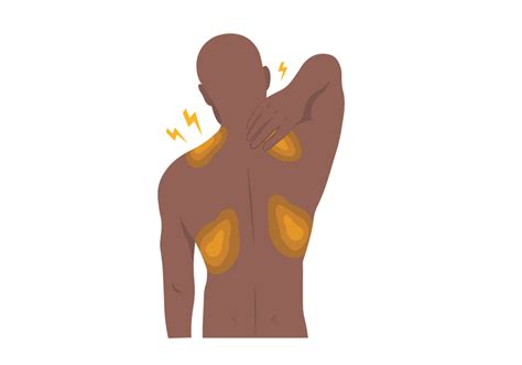 Myofascial Pain Syndrome: Causes, Symptoms, And Treatment, 55% OFF