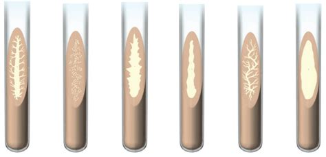 Agar Slant Growth Patterns Diagram | Quizlet