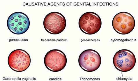 Gardnerella Symptoms and testing - RUClear