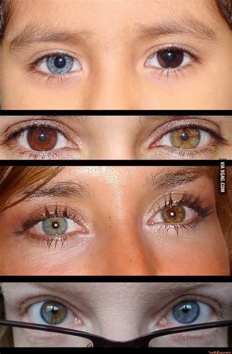 Heterochromia Iridis * - Heterochromia (Greek : heteros 'different ...