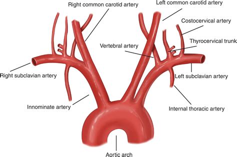 subclavian artery - Yahoo 圖片搜尋結果 | Subclavian artery, Arteries ...