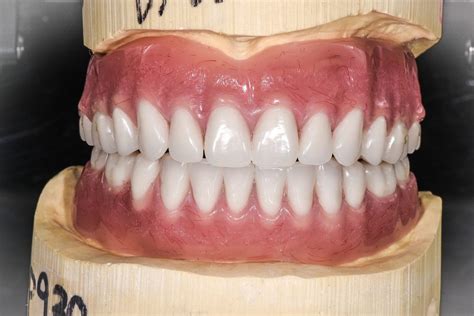 Full Dentures • Triad Dental Studio