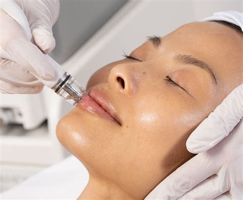 Diamond glow facial - Ladermaspa