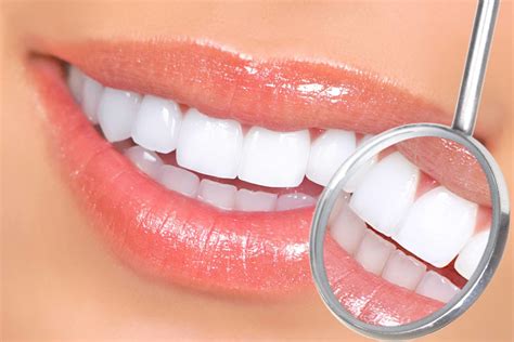 Teeth Whitening – Stockton Family & Cosmetic Dentistry