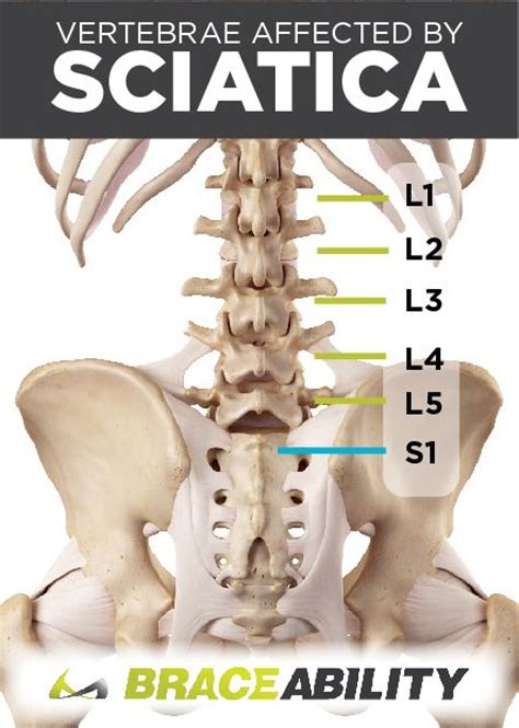 Pin on Back Injuries & Spine Disorders | What's Causing my Back Pain? Lower, Middle, & Upper ...