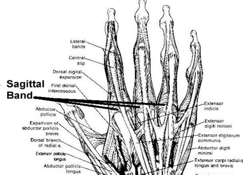 https://whatisapergers.files.wordpress.com/2013/03/hand-sagittal-band ...