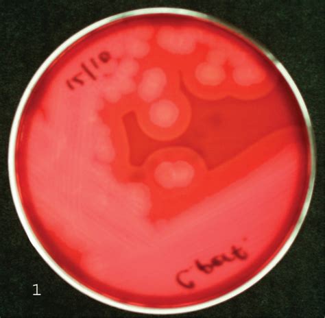 Diagnosis of Clostridium Perfringens Intestinal Infections in Sheep and Goats - Francisco A ...