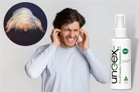 Ear Mites in Humans: Kinds, Signs, Prevention, and Remedy | Ungex