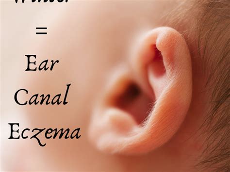 Winter = Ear Canal Eczema