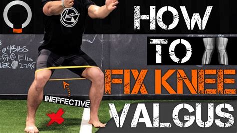 Fix Knee Valgus: How To Fix Knee Valgus | Knee exercises, Leg training, Exercise