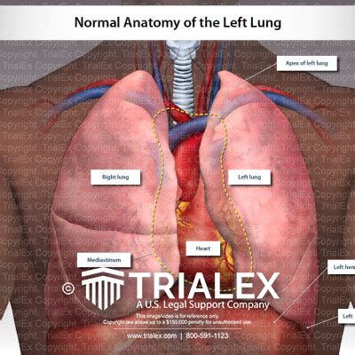 Medical Legal Exhibits - Legal Animations & Trial Graphics - Tria...