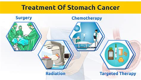 Stomach cancer - Best oncologist in Delhi - Oncoplus Hospital